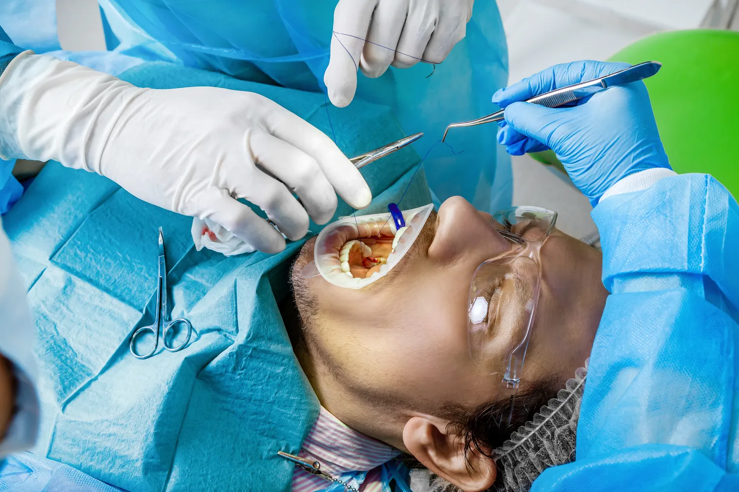 Jaki jest koszt implantów całej szczęki?