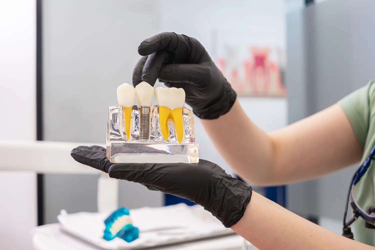 Kiedy po wyrwaniu zęba można wstawić implant?