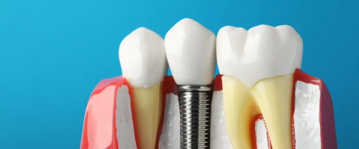 Endodoncja ranking Szczecin