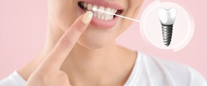 Licówki ranking Szczecin