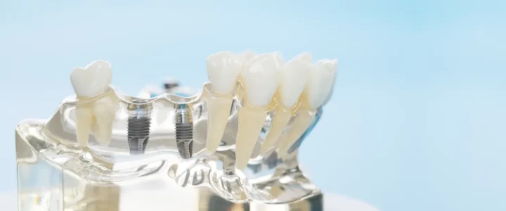 Najlepszy gabinet stomatologiczny Warszawa