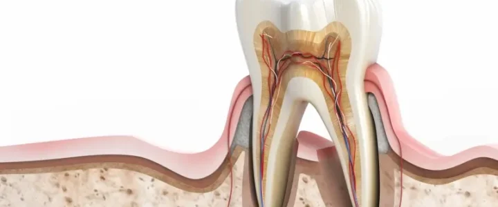 Najlepszy licówki Szczecin