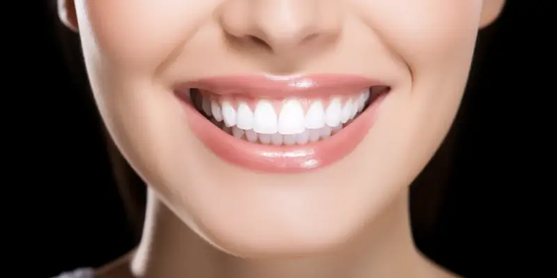 Różnice między licówkami porcelanowymi a kompozytowymi