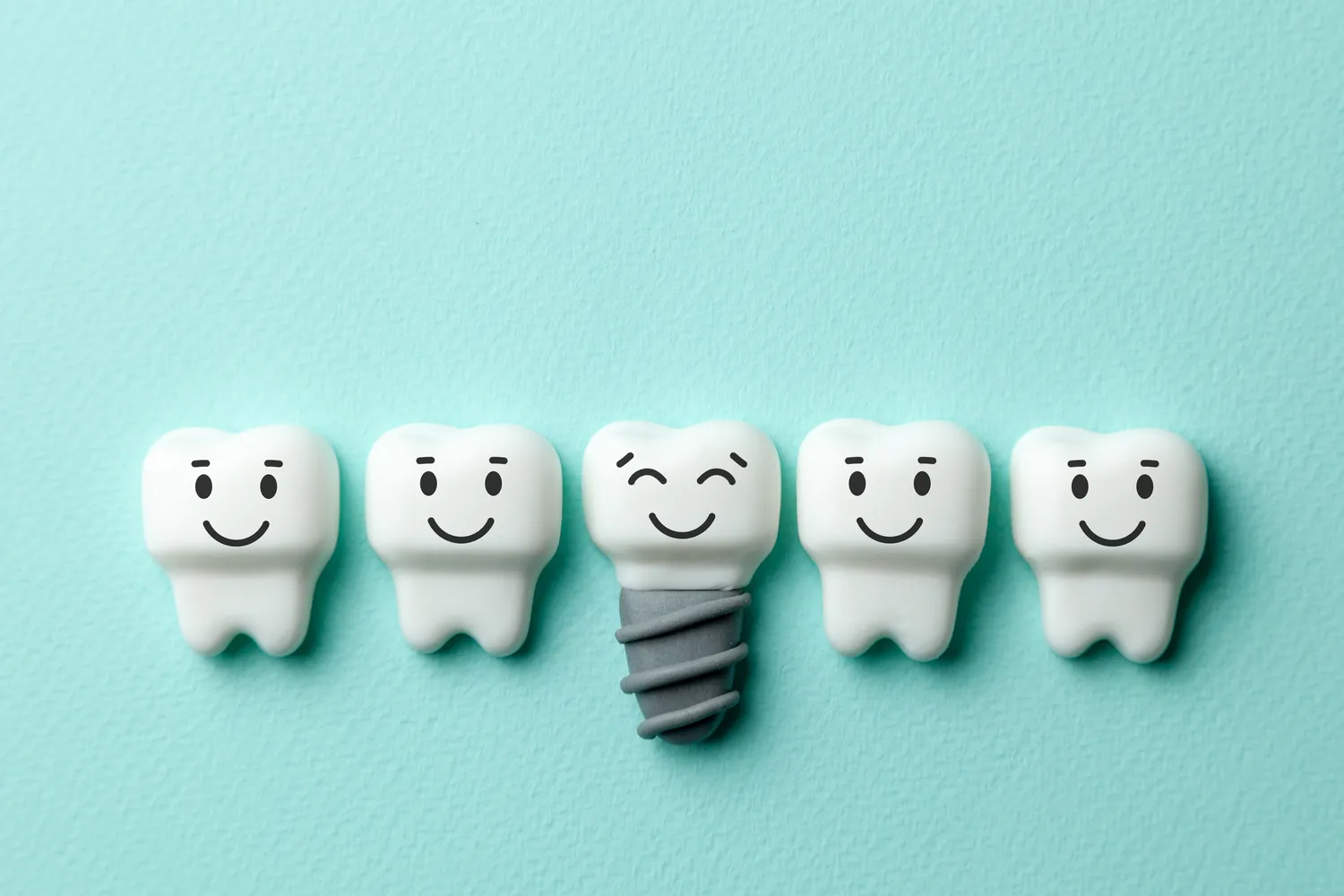 Kto wymyślił implanty stomatologiczne?